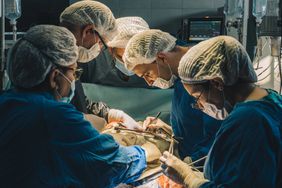 a team of surgeons in blue scrubs operating on a person during open heart surgery