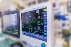 Monitors used during Cardiac Surgery