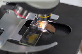 Finding parasites in feces in laboratory.