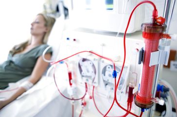 person with chronic kidney failure lying on hospital bed while hooked up to dialysis machine