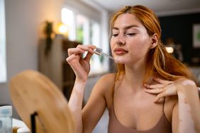 Young redhead Caucasian woman with acne applying benzoyl peroxide serum