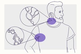 Health Overview Illustration - Hodgkin Lymphoma