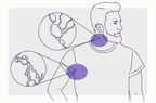 Health Overview Illustration - Hodgkin Lymphoma