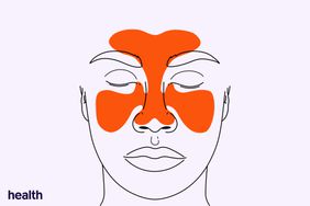 Health Illustration Composite - Sinus Infection
