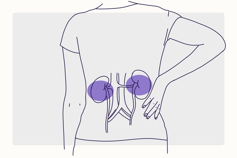 Health Overview Illustration - Kidney Disease