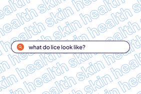 Skin Health Template - Lice