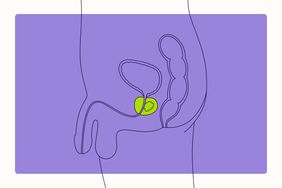 Health Overview Illustration - Prostate Cancer