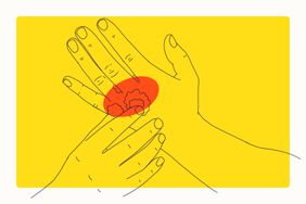 Illustration of Psoriatic Arthritis