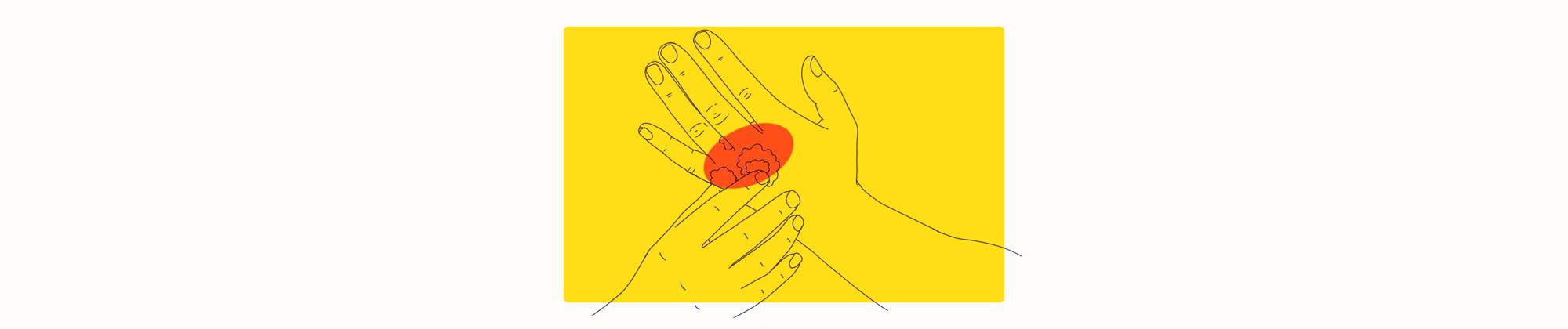 Illustration of Psoriatic Arthritis