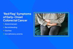 Health Photo Composite - Colon Cancer