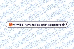 Skin Health Template -red blotches