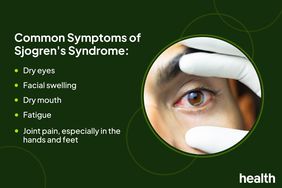Health Photo Composite - Sjogren's Syndrome