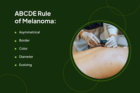 Health Photo Composites - Skin Cancer