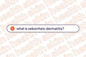 Skin Health Template- What Is Seborrheic Dermatitis?