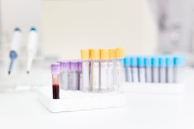 blood sample tubes