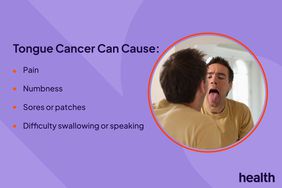 Health Photo Composite - Tongue Cancer