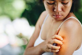 A closeup of a woman scratching red skin on arm.