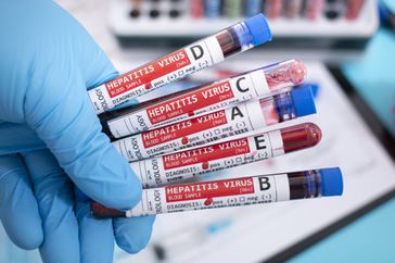 doctor testing patient's blood for hepatitis cause