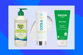 collage of sunburn relief products