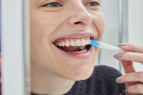 Person using a teeth whitening emulsion on upper teeth