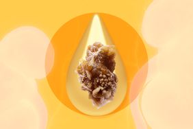 Man Peed Out a Kidney Stone—Here's What to Know