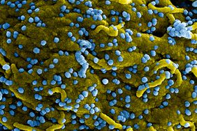 Colorized scanning electron micrograph of Marburg virus particles (blue) both budding and attached to the surface of infected VERO E6 cells (yellow). Image captured and color-enhanced at the NIAID Integrated Research Facility in Fort Detrick, Maryland. Credit: NIAID. (Photo by: IMAGE POINT FR/NIH/NIAID/BSIP/Universal Images Group via Getty Images)