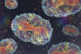 Monkeypox virus particle