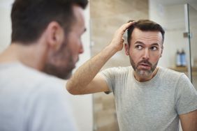 A man looking at his receding hairline in the mirror