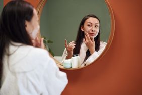 person with rosacea putting on cream to treat symptoms