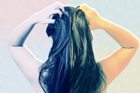 Scalp-Psoriasis-vs-Dandruff-AdobeStock_171767980
