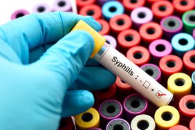 syphilis blood test 