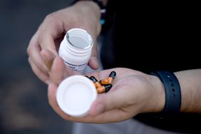 Kyle Planck, 26, who has recovered from monkeypox, shows Tecovirimat capsules, which is used for monkeypox treatment, during an interview in New York on July 19, 2022. - I don't want anyone to have to go through what I went through just cured of monkeypox, which gave him "the worst pain of his life" despite rapid treatment, Planck, 26, regrets the lack of response from health authorities when the epidemic appeared in the US. (Photo by Yuki IWAMURA / AFP) (Photo by YUKI IWAMURA/AFP via Getty Images)