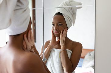 woman with vitiligo looking at her face in the mirror 
