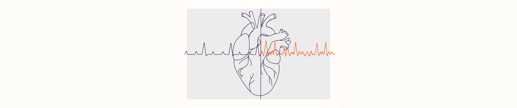 Health Overview Illustration - Atrial Fibrillation