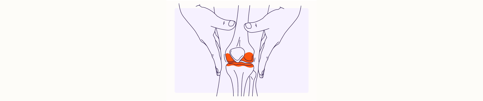 Health Overview Illustration - Arthritis