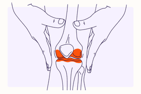 Health Overview Illustration - Arthritis