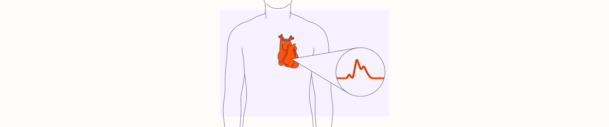 Health Illustration Overview - Cardiac Arrest