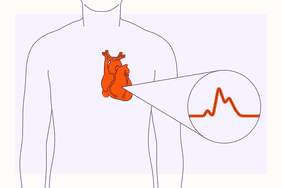 Health Overview Illustration - Cardiac Arrest