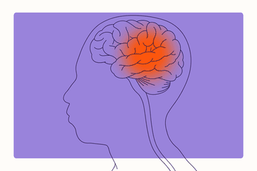 Health Overview Illustration - Epilepsy