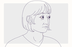Health Photo Composite - Graves' Disease