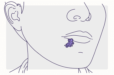 Health Overview Illustration - Herpes