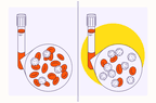 Health Overview Illustration - Leukemia