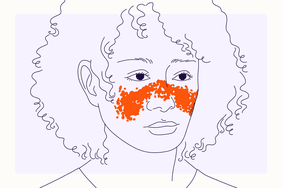Health Overview Illustrations - Lupus