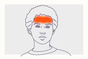 Health Overview Illustration - Tension Headache