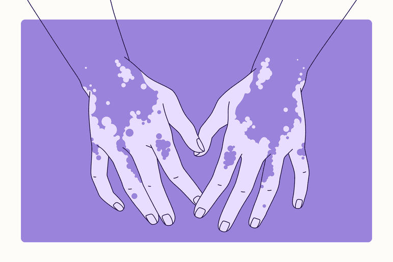 Health Overview Illustration - Vitiligo